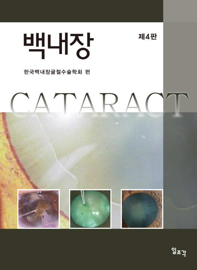 백내장 = Cataract / 한국백내장굴절수술학회 편