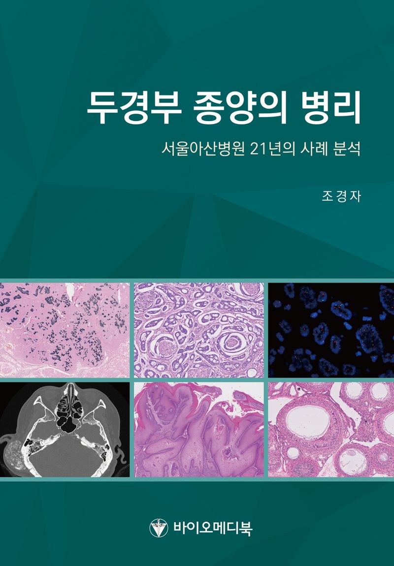 두경부 종양의 병리 : 서울아산병원 21년의 사례 분석 / 지은이: 조경자