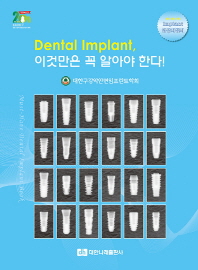 Dental implant, 이것만은 꼭 알아야 한다 = Must-have dental implant book / 저자: 대한구강악안면임프란트학회