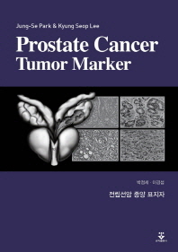 Prostate cancer tumor marker = 전립선암 종양 표지자 / 저자: 박정세, 이경섭