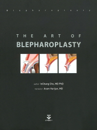 The art of blepharoplasty / author: Inchang Cho ; translator: Aram Harijan