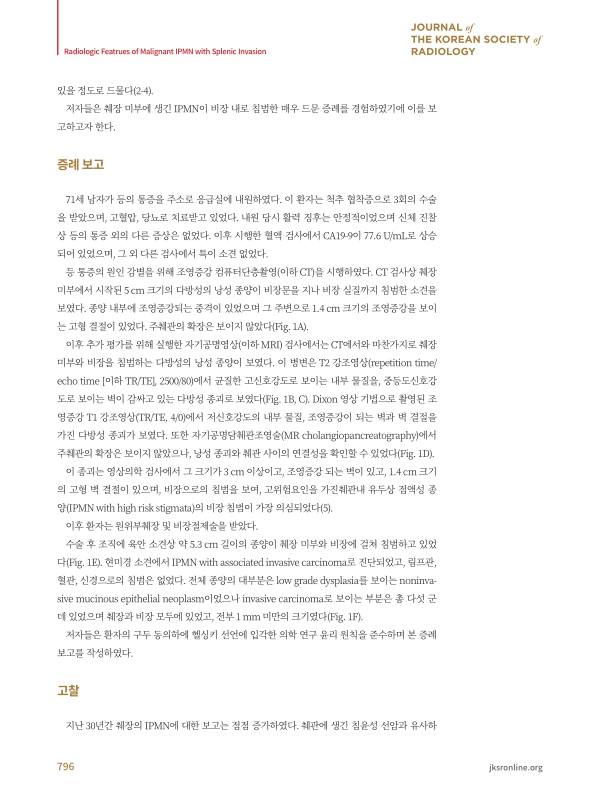 미리보기 이미지 2번째