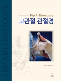 고관절 관절경 = Hip arthroscopy