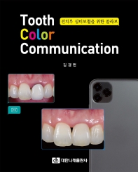 Tooth color communication : 전치부 심미보철을 위한 콜라보