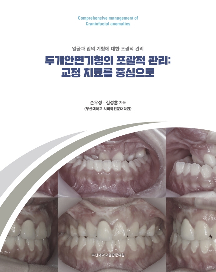 두개안면기형의 포괄적 관리 = Comprehensive management of craniofacial anomalies : 교정 치료를 중심으로 : 얼굴과 입의 기형에 대한 포괄적 관리