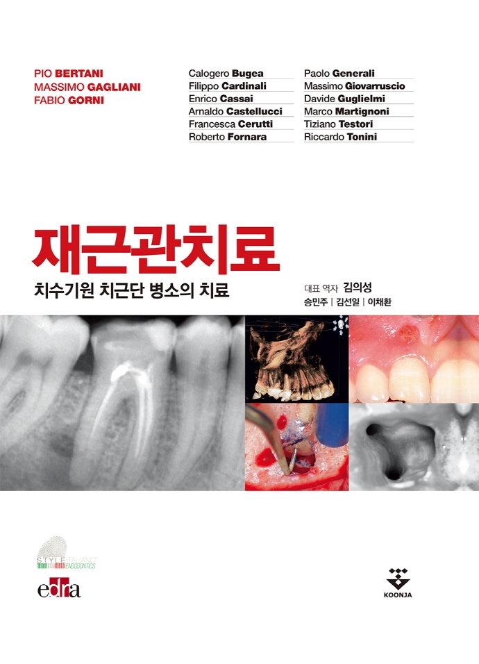 재근관치료 : 치수기원 치근단 병소의 치료