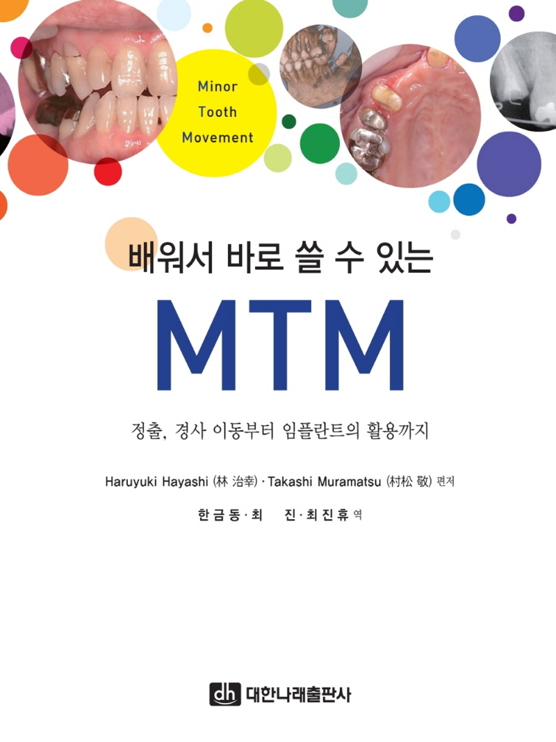 (배워서 바로 쓸 수 있는) MTM : 정출, 경사 이동부터 임플란트의 활용까지