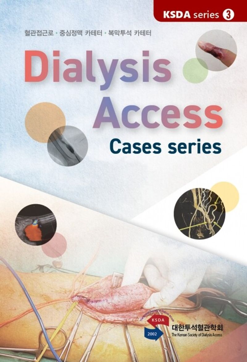 Dialysis access : cases series : 혈관접근로·중심정맥 카테터·복막투석 카테터