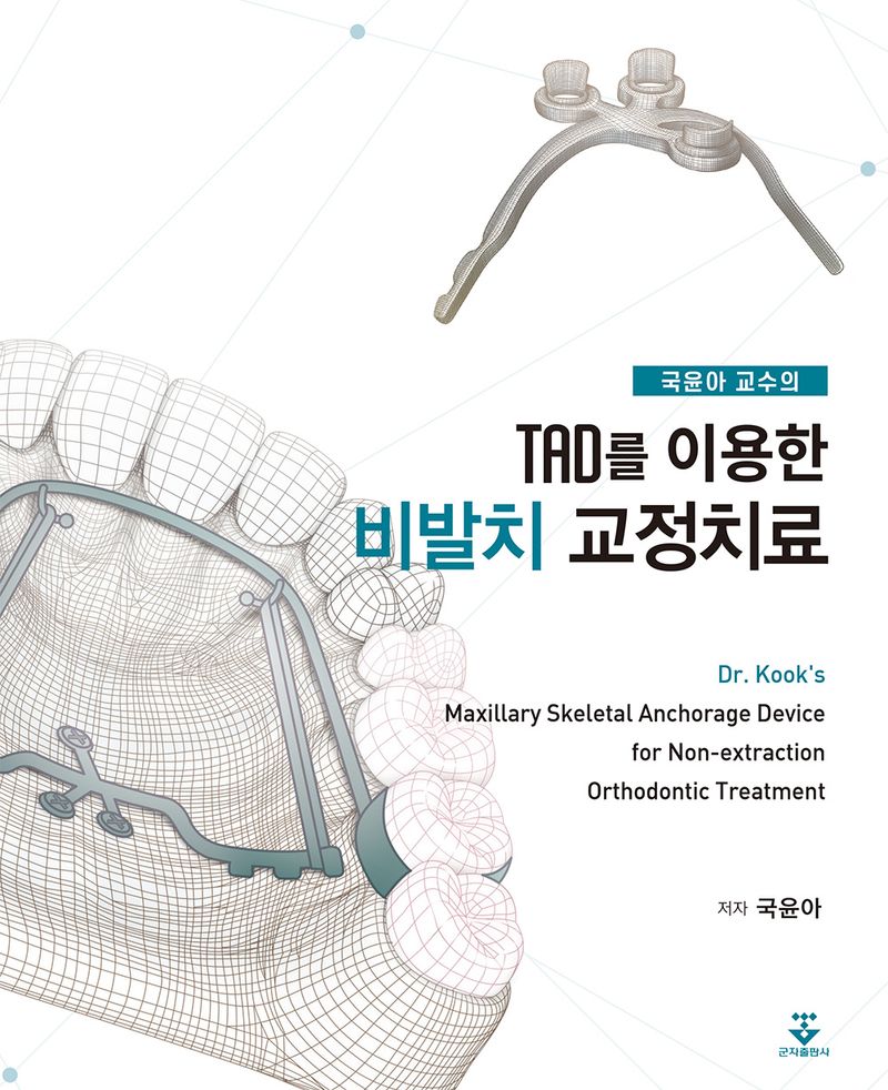 (국윤아 교수의) TAD를 이용한 비발치 교정치료