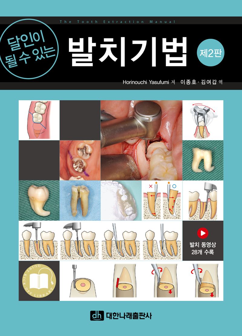 (달인이 될 수 있는) 발치기법 = The tooth extraction manual