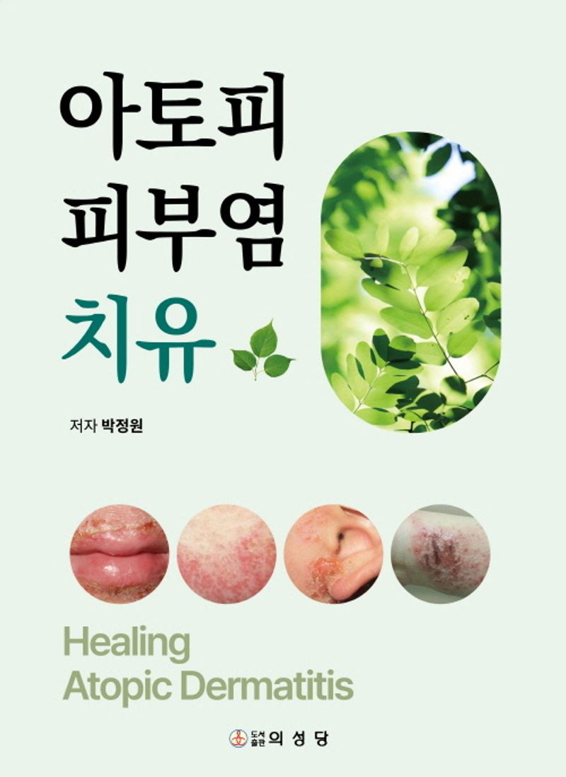 아토피 피부염 치유 = Healing atopic dermatitis