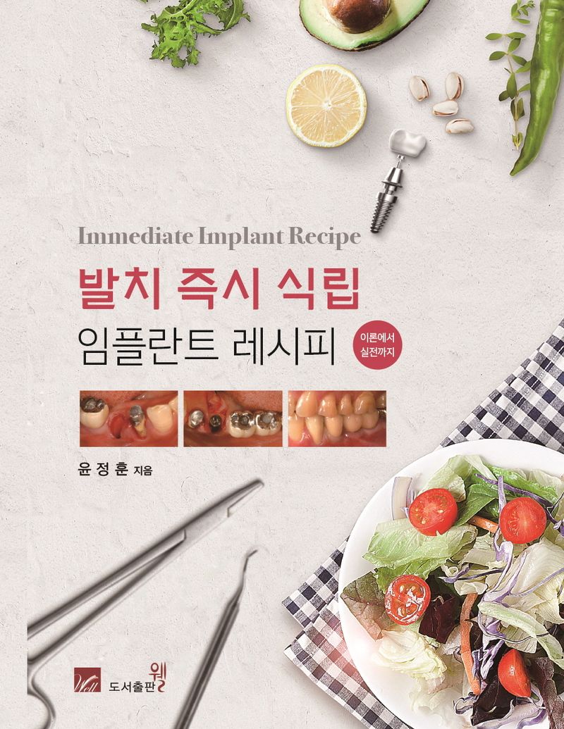 발치 즉시 식립 임플란트 레시피 = Immediate implant recipe : 이론에서 실전까지