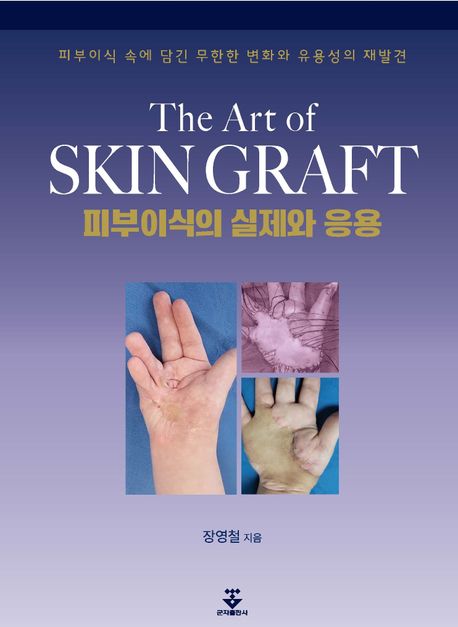 피부이식의 실제와 응용 = The art of skin graft : 피부이식 속에 담긴 무한한 변화와 유용성의 재발견