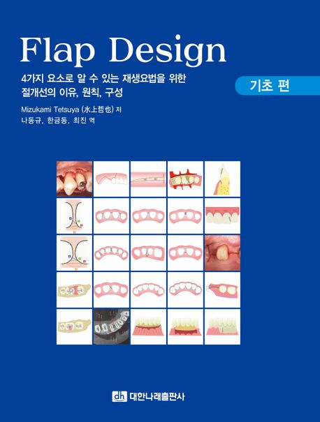 Flap design : 4가지 요소로 알 수 있는 재생요법을 위한 절개선의 이유, 원칙, 구성. 기초 편