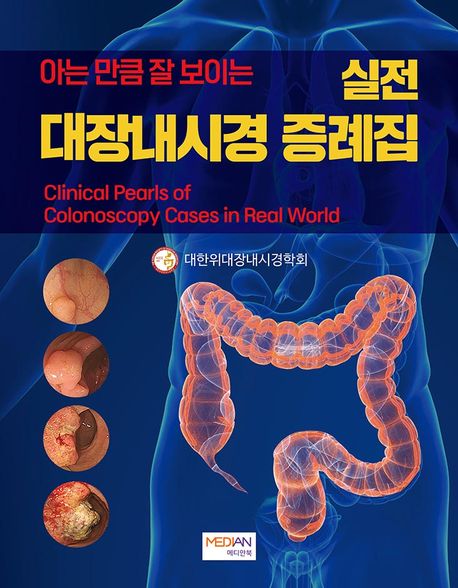 (아는 만큼 잘 보이는) 실전 대장내시경 증례집 = Clinical pearls of colonoscopy cases in real world