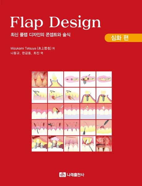 Flap design : 최신 플랩 디자인의 콘셉트와 술식. 심화 편