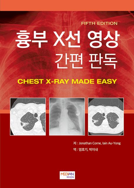 흉부 X선 영상 간편 판독