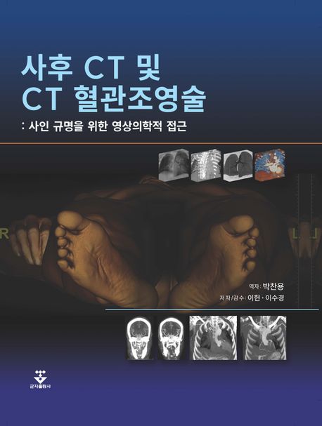 사후 CT 및 CT 혈관조영술 : 사인 규명을 위한 영상의학적 접근