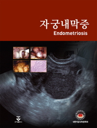 자궁내막증 = Endometriosis / 지은이: 대한자궁내막증학회