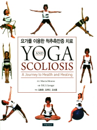 요가를 이용한 척추측만증 치료