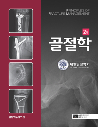 골절학 = Principles of fracture management