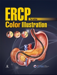 ERCP color illustration