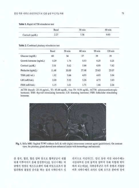 분만 직후 나타난 쉬한증후군으로 인한 급성 부신기능저하 | 국회도서관 국회전자도서관