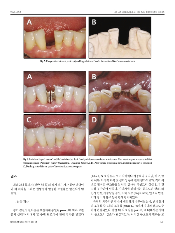 미리보기 이미지 4번째