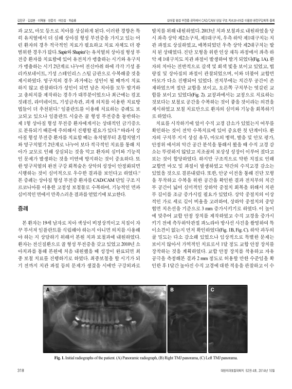 미리보기 이미지 2번째