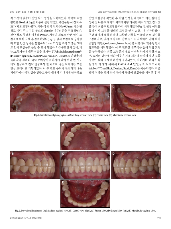 미리보기 이미지 3번째