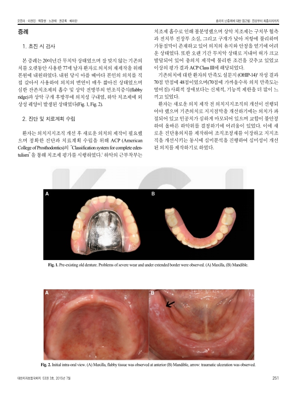 미리보기 이미지 2번째