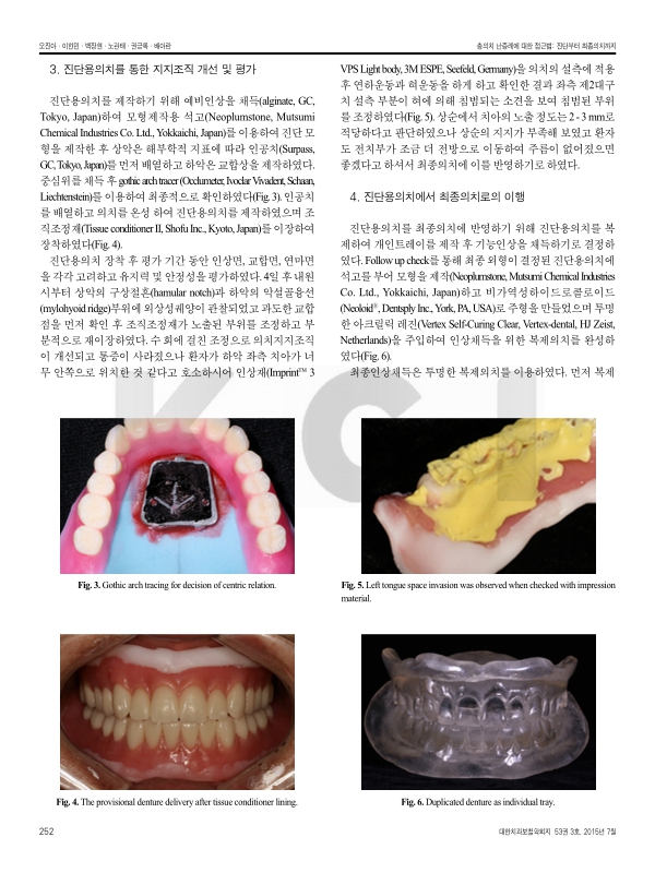 미리보기 이미지 3번째
