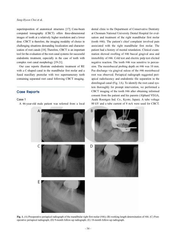 미리보기 이미지 2번째