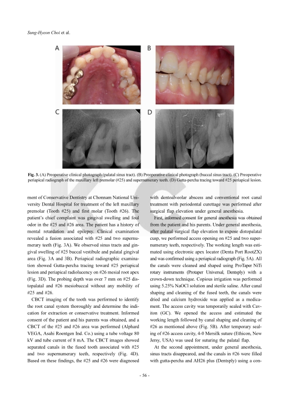 미리보기 이미지 4번째