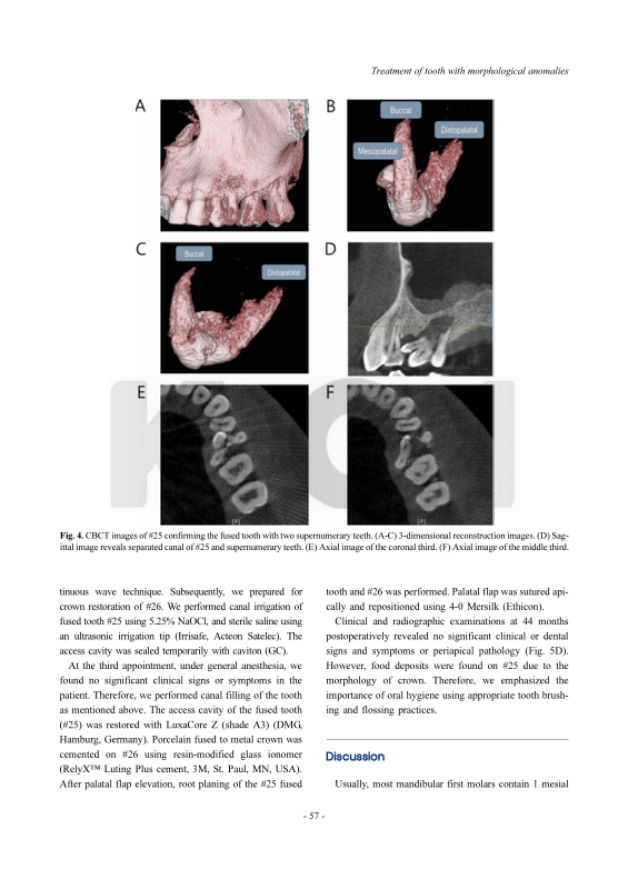 미리보기 이미지 5번째