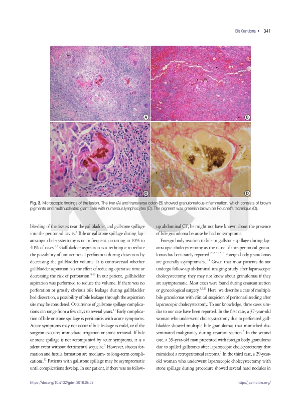 미리보기 이미지 3번째