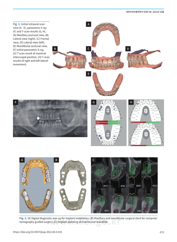 미리보기 이미지 3번째